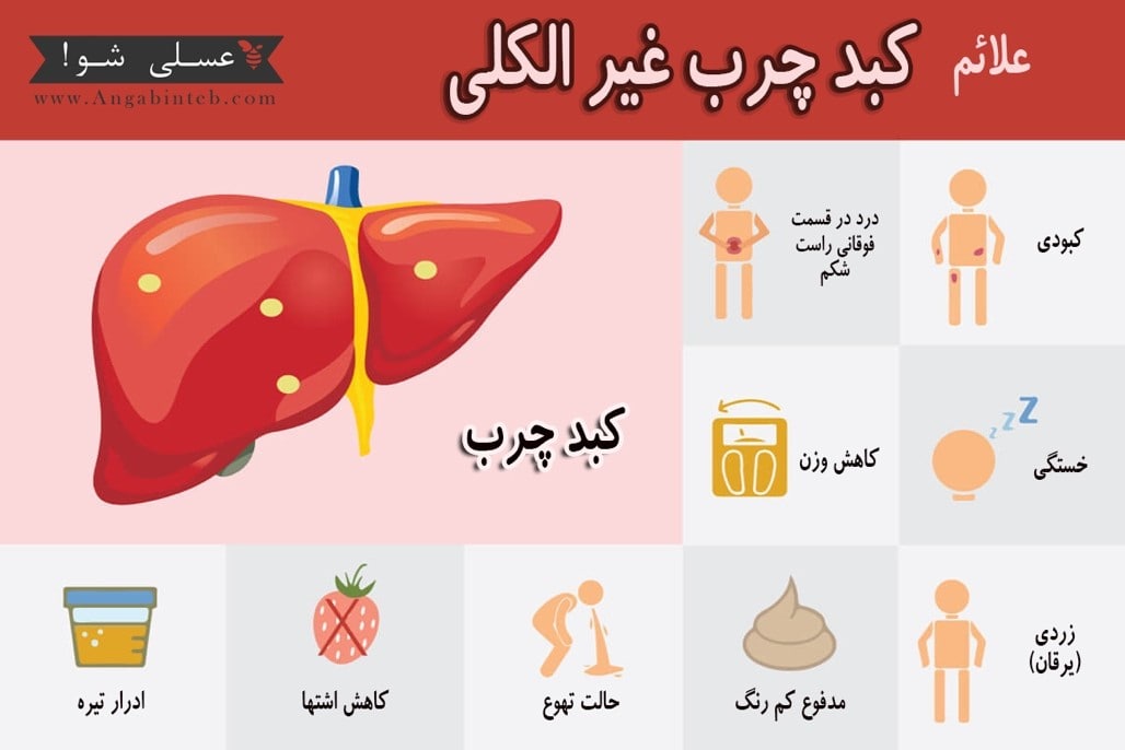 کبد چرب غیر الکلی - انگبین طب