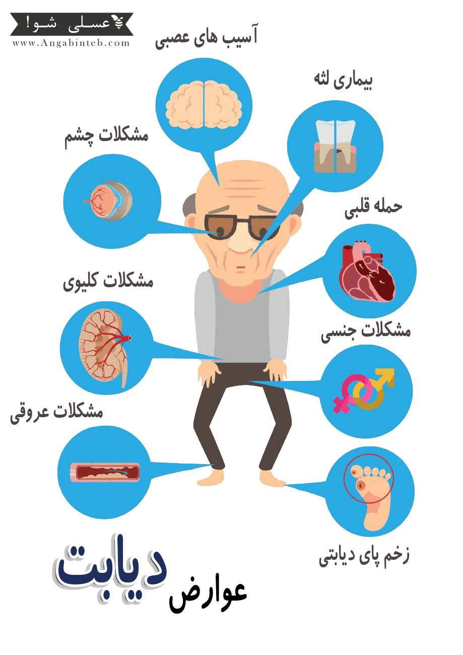 دیابت و انواع آن | انگبین طب